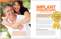 Article - Implant Overdentures for the Lower Jaw