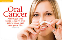 Article - Oral Cancer