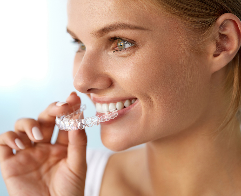 Young girl wearing aligner