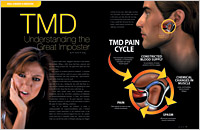 Article - TMD - The Great Impostor