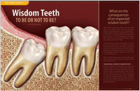 Article - Wisdom Teeth - To Be Or Not To Be