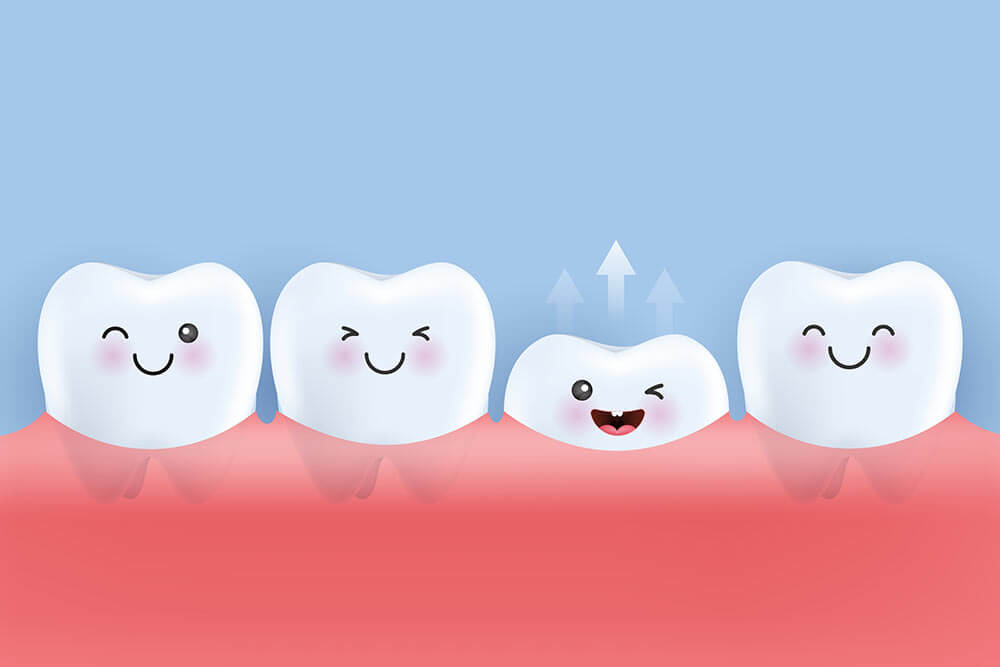 Tooth growing up from gum and other teeth are smiling - illustration