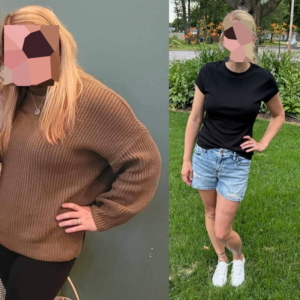 Weight loss result after treatment