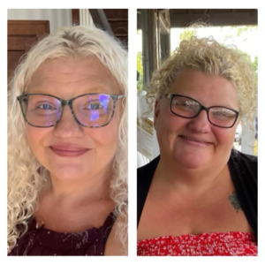 Weight loss result after treatment