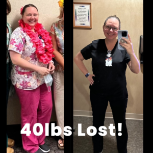 Weight loss result after treatment