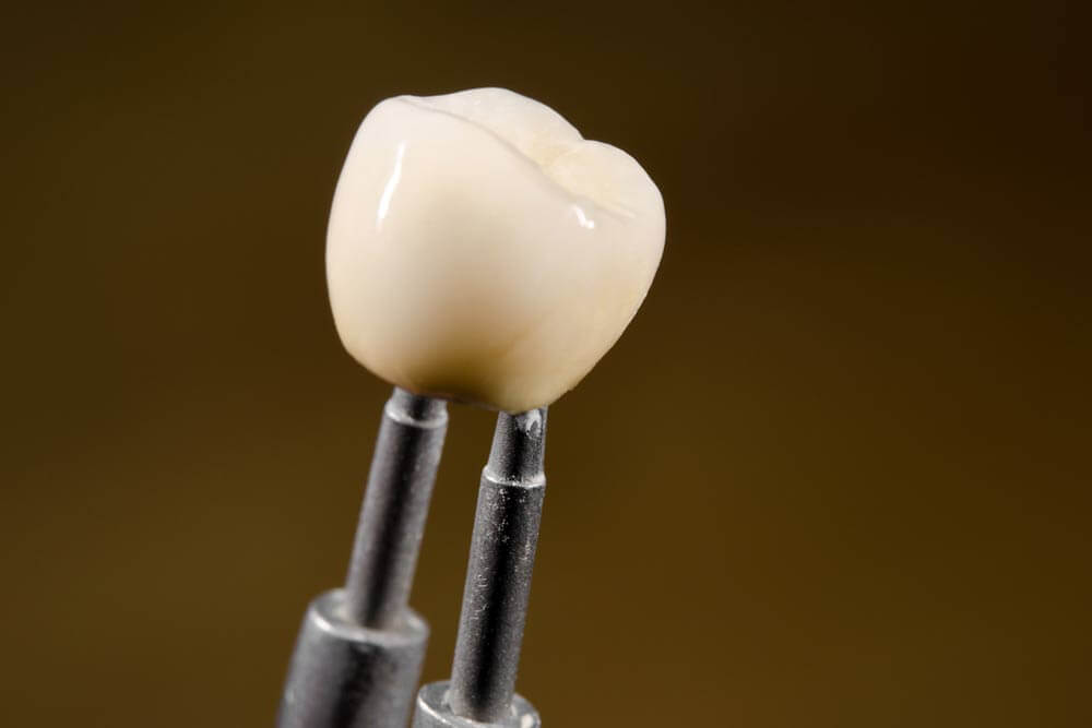 ceramic dental crown