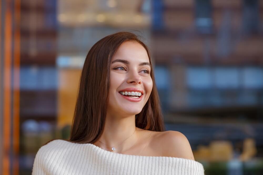 Attractive girl bracket system posing in city outdoor