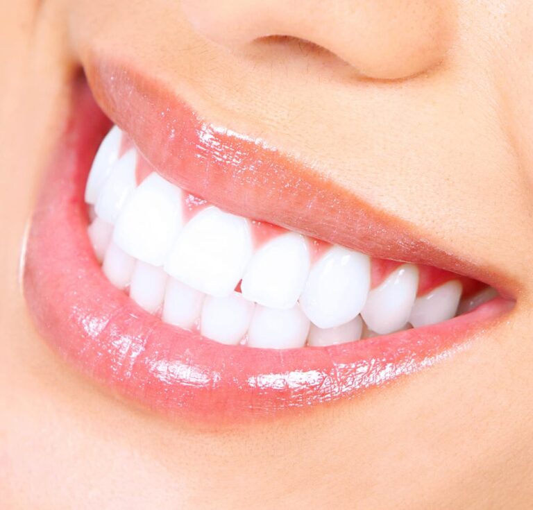 Woman with shiny smile
