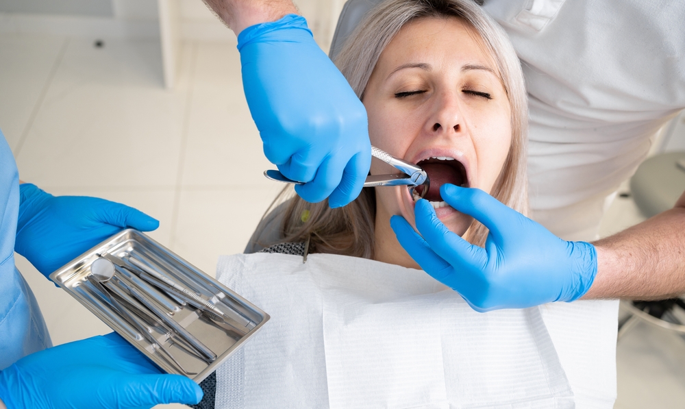A dentist in blue latex gloves removes her tooth with a buccal retractor and forceps