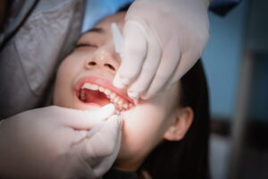 Dentist extracting teeth for young Asian woman