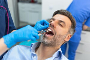 Doctor performing extraction procedure with forceps removing patient tooth.