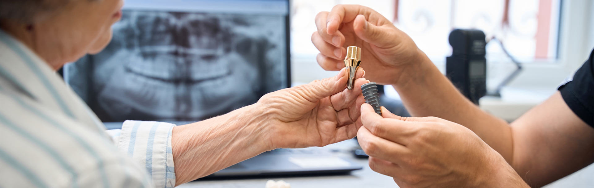 Doctor shows a model of a dental implant to patient