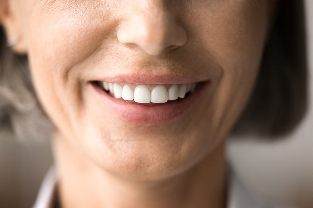 beautiful older woman smile after whitening procedure