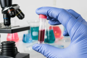 Doctor with blood sample