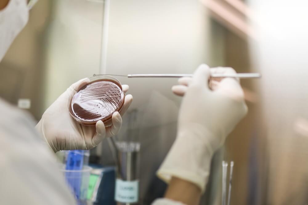 A research laboratory Streak colony on a petri dish in microbiology lab