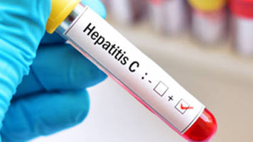 Blood sample positive with hepatitis C virus