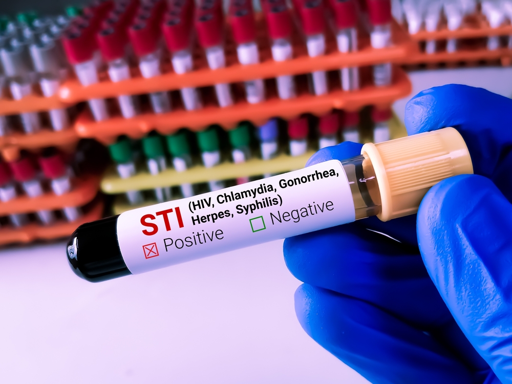 DoxyPEP: How It Works for STI Prevention and Who Should Use It