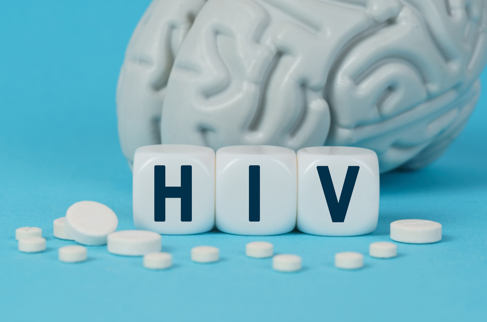 Medicine and health. Cubes lie on the table among the pills and imitation of the brain. The text on the dice - HIV