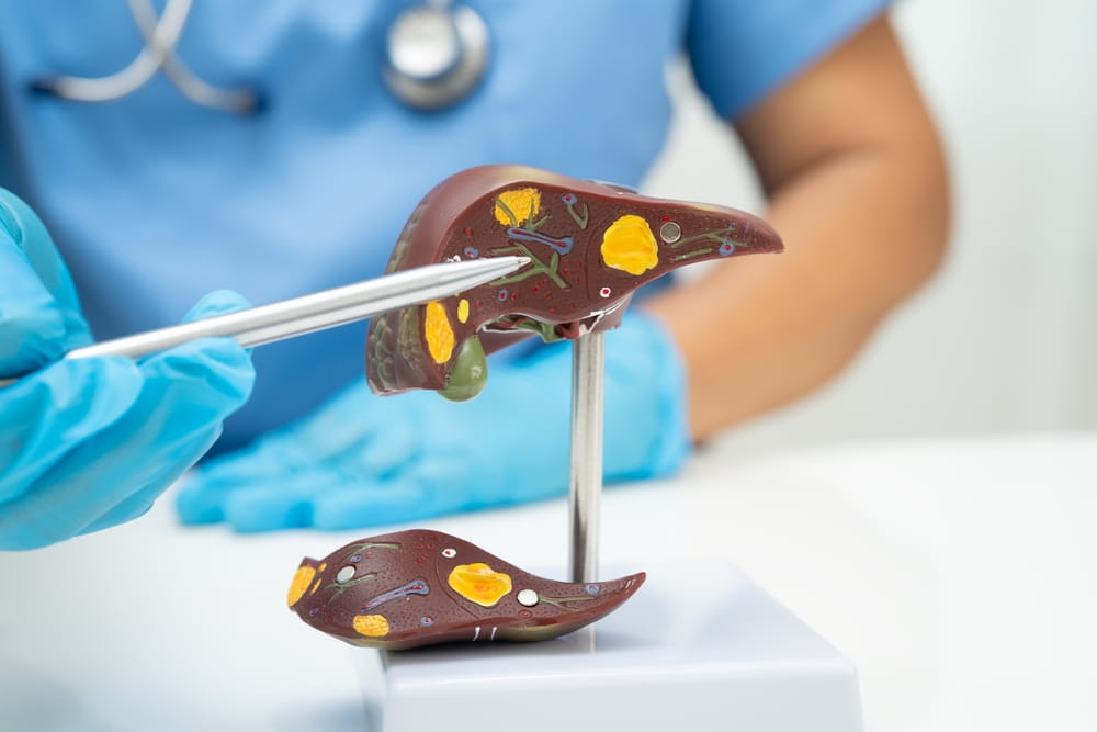 Cirrhosis, Liver cancer, fatty liver, Asian doctor with liver human anatomy model in World Hepatitis Day at hospital.