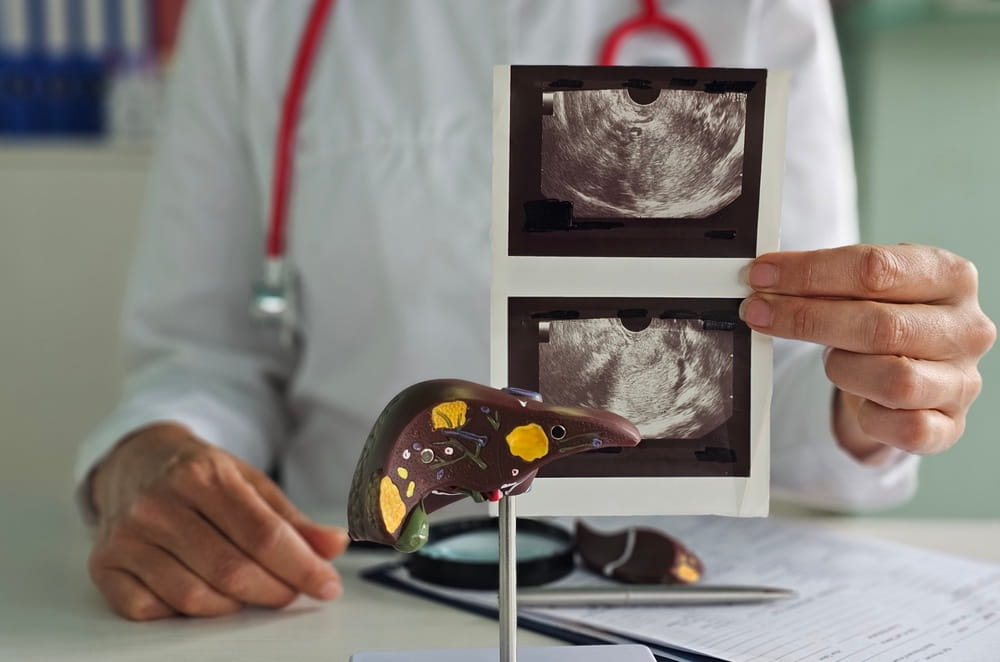 Doctor shows ultrasound images while discussing liver health with a patient in an office setting