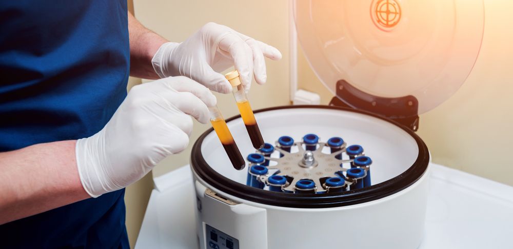 Platelet-Rich plasma preparation. Tube with blood in hands. Centrifuge.