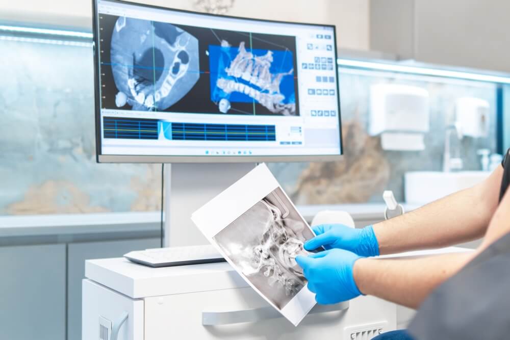 Dentist showing patient x-ray with plan and result of treatment