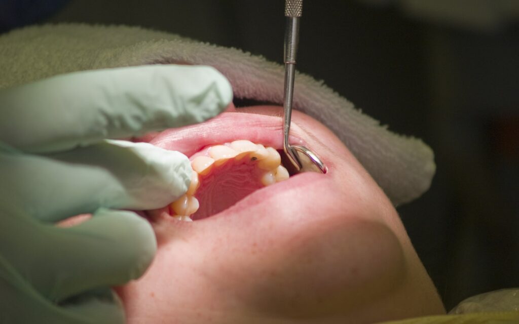 Dentist performing treatment