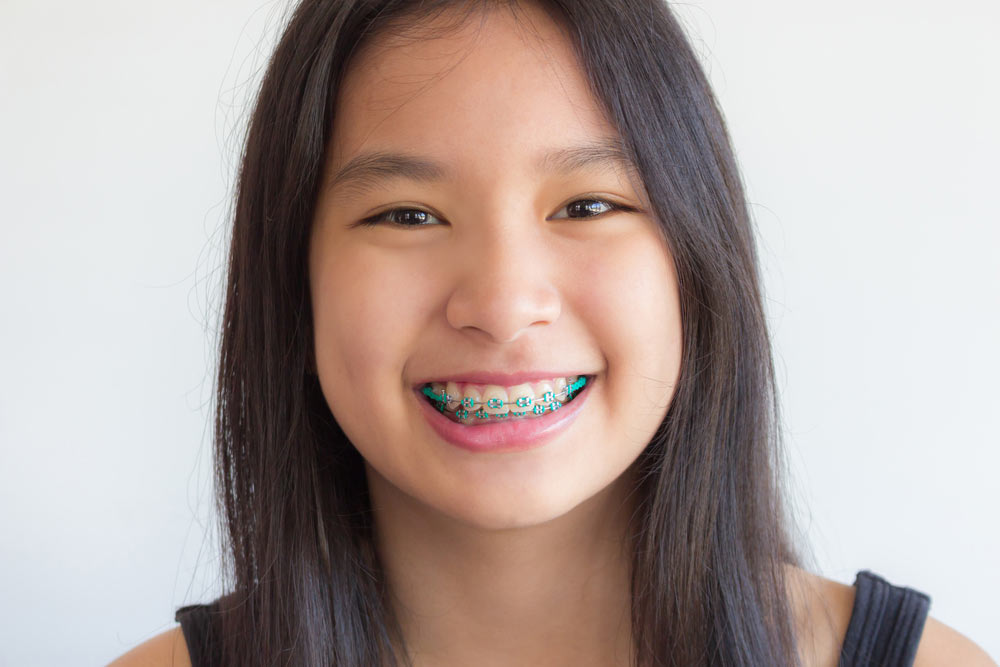 Teen age girl wearing braces