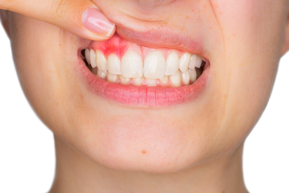 woman having gum disease