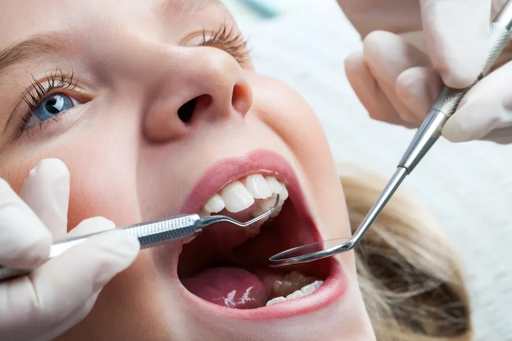 Macro close up of young child with open mouth at dentist.