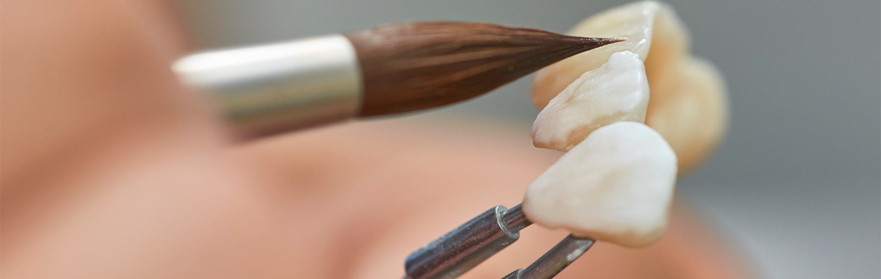 dental technician putting ceramic to dental implants in his laboratory