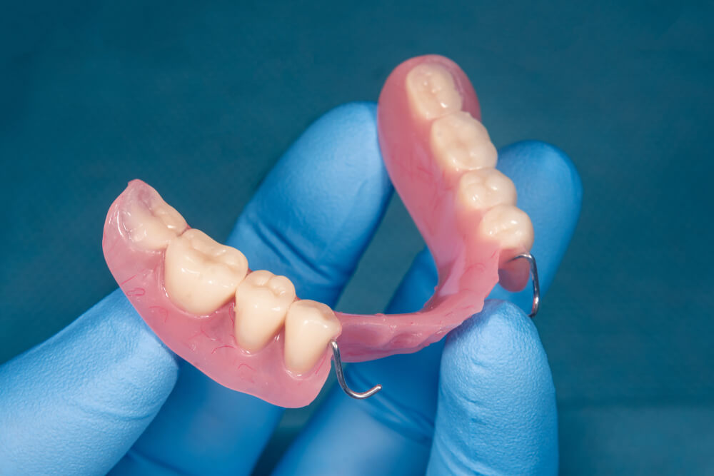 partial dentures