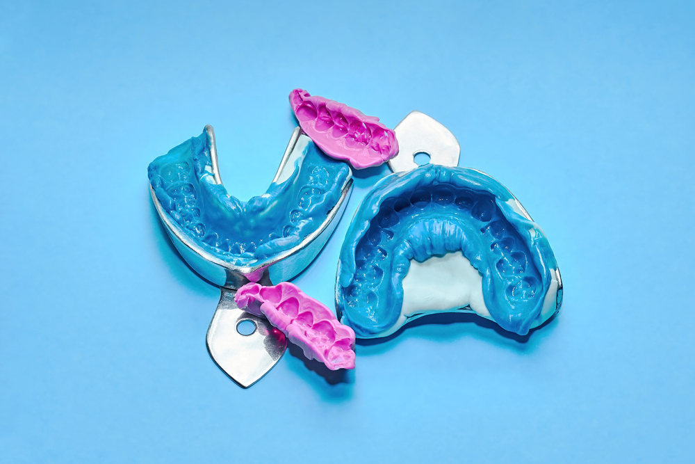 Two dental impressions on a white and blue background