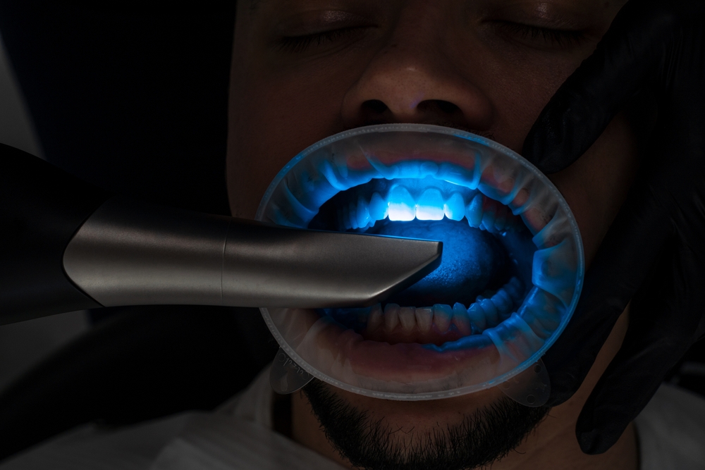 Dental 3d scanner applying process. Digital impressioning teeth of patient with 3d digital dental scanner