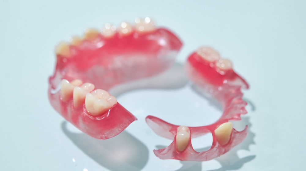 Partial dentures with flexible materials are one type of denture in the world of dentistry