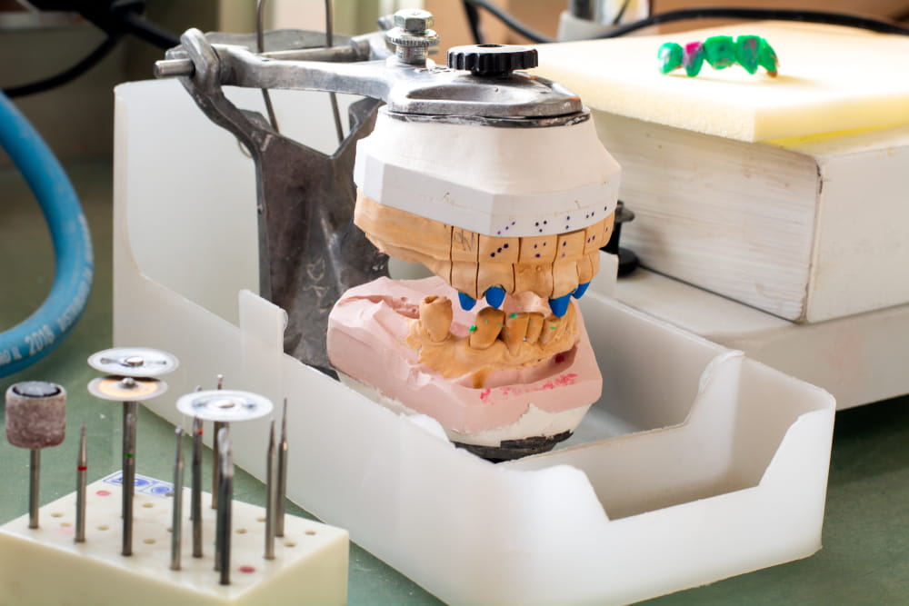 dental prosthesis. still life in the dental laboratory. Construction and testing of dental prostheses