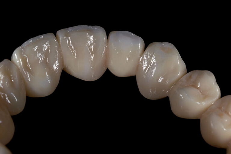 Monolithic zirconia teeth