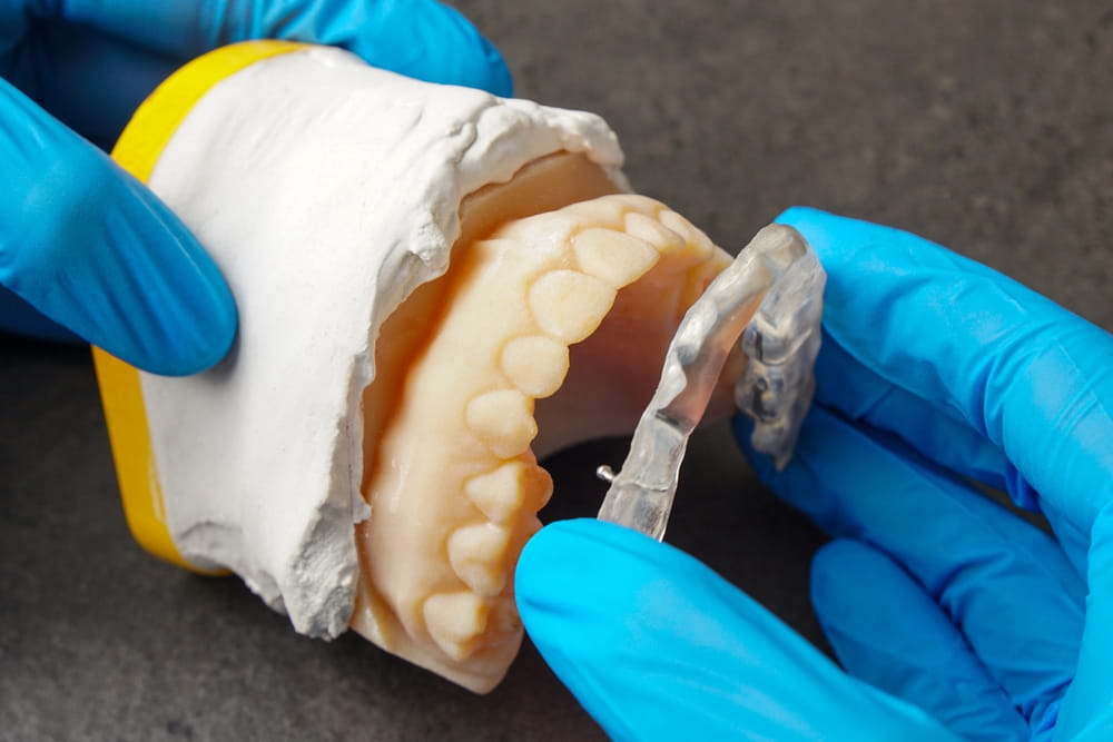 Dentist adjusting a dental splint, a device made for occlusion problems, bruxism or as retainer after braces.