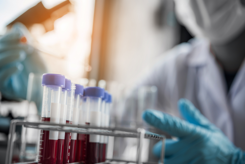 Lab technician assistant analyzing a blood sample in test tube