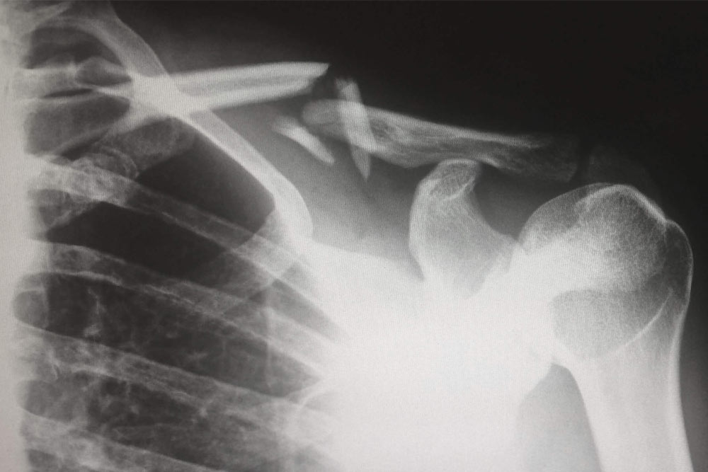 X-ray image