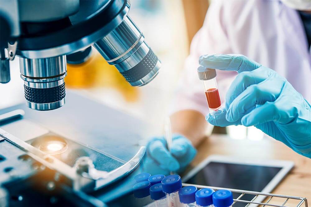 lab technician analyzing a blood sample in test tube