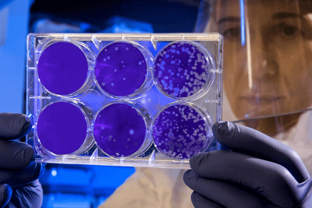 Scientist is counting cells infected with virus
