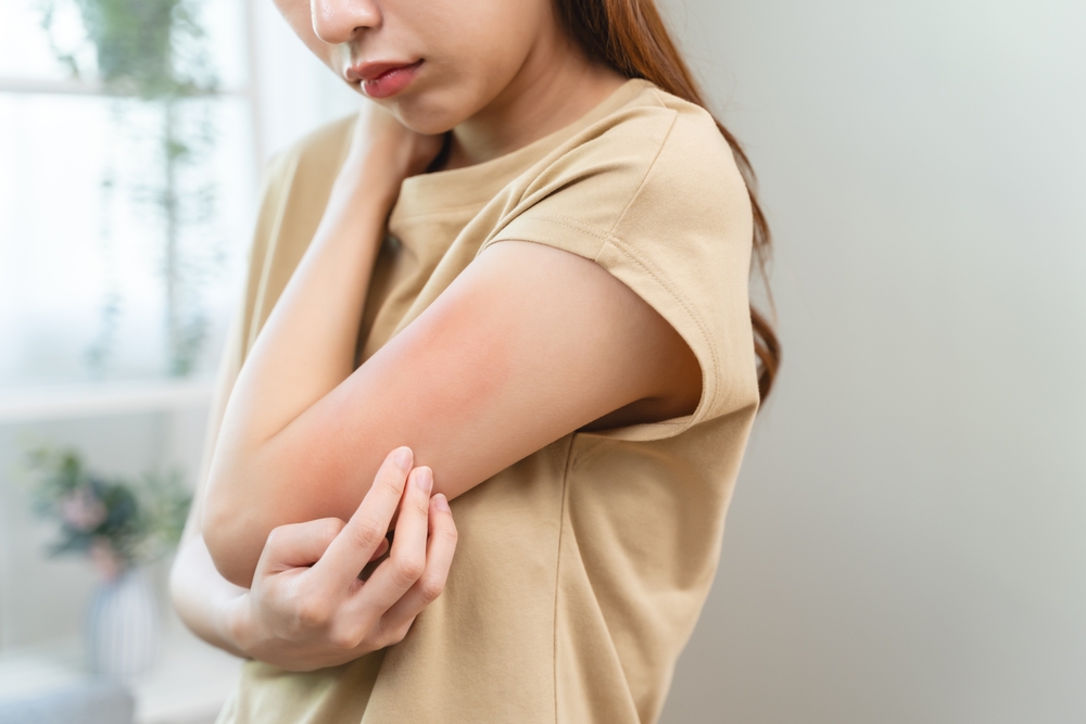 Sunburn or Rash What Urgent Care Can Treat