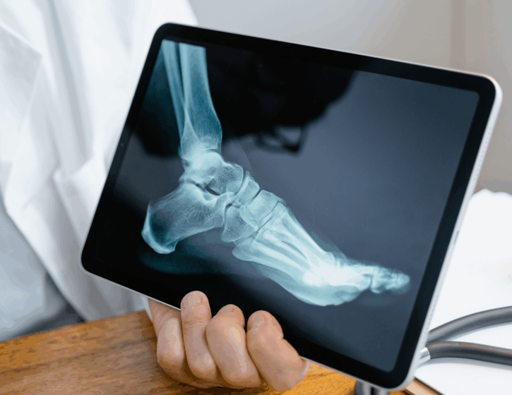 x-ray of a foot presented on a tablet by a medical provider