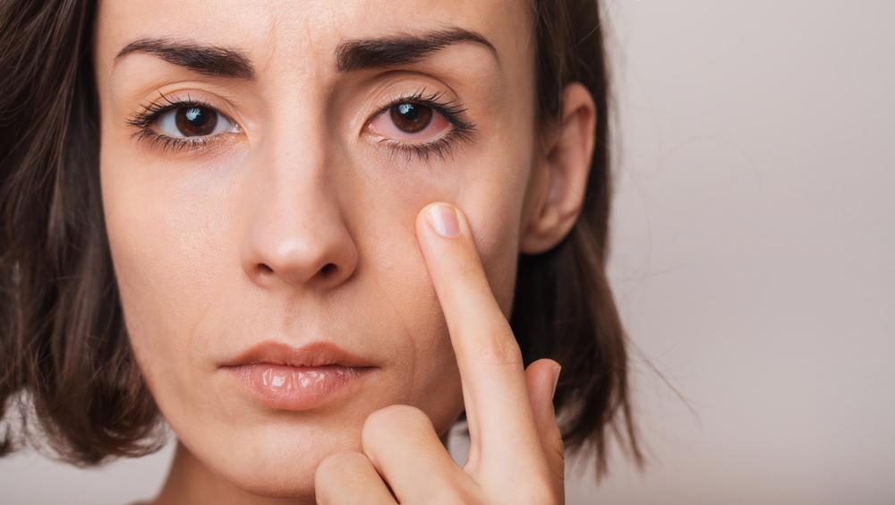 Eye Redness or Discomfort When It’s Time to See a Provider