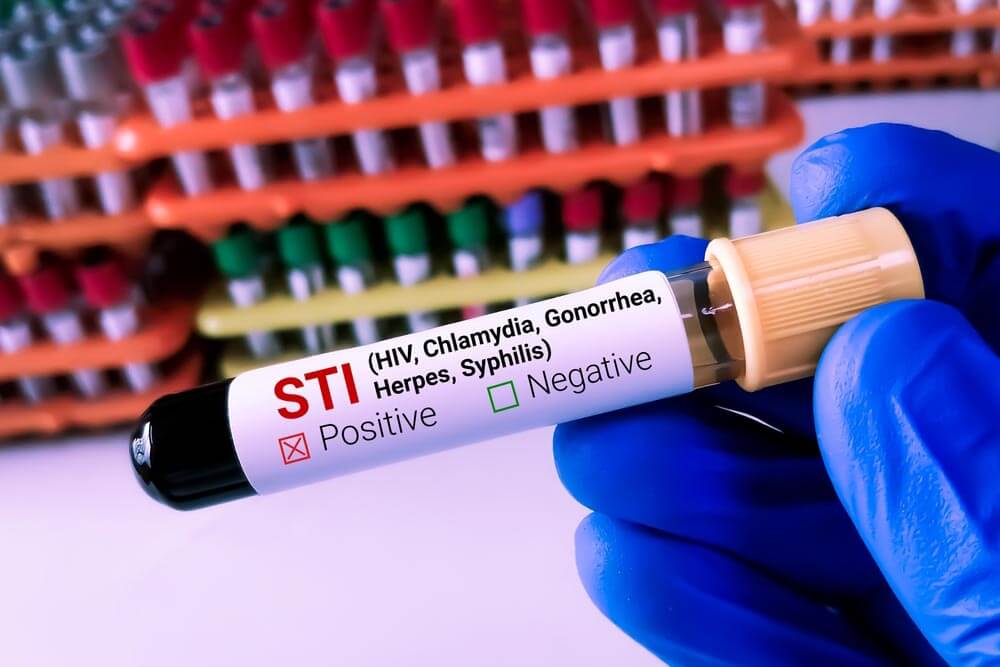 Lab Technologist holds Blood sample for STI