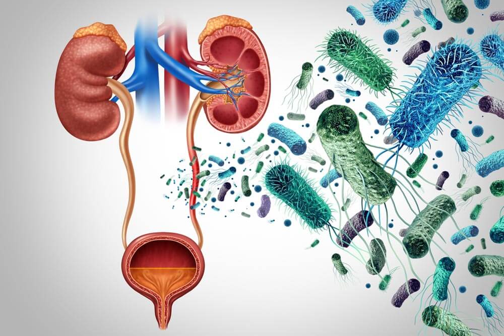 Urinary Tract Bacterial Infection