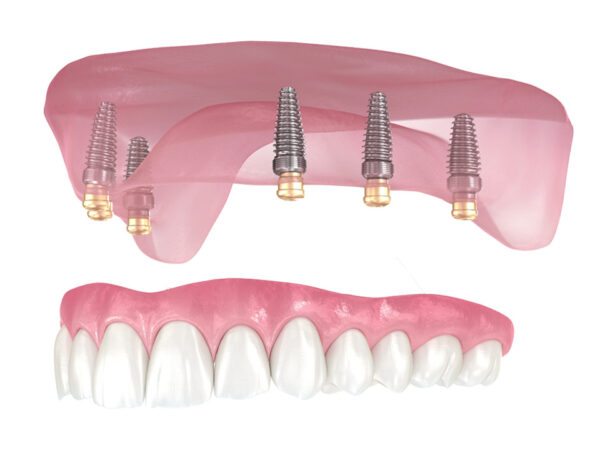 Click Tight Dentures