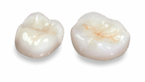 crowns
