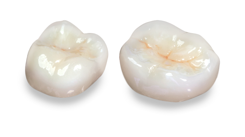 crowns